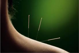 Acupuncture